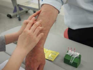 鍼と灸の体験